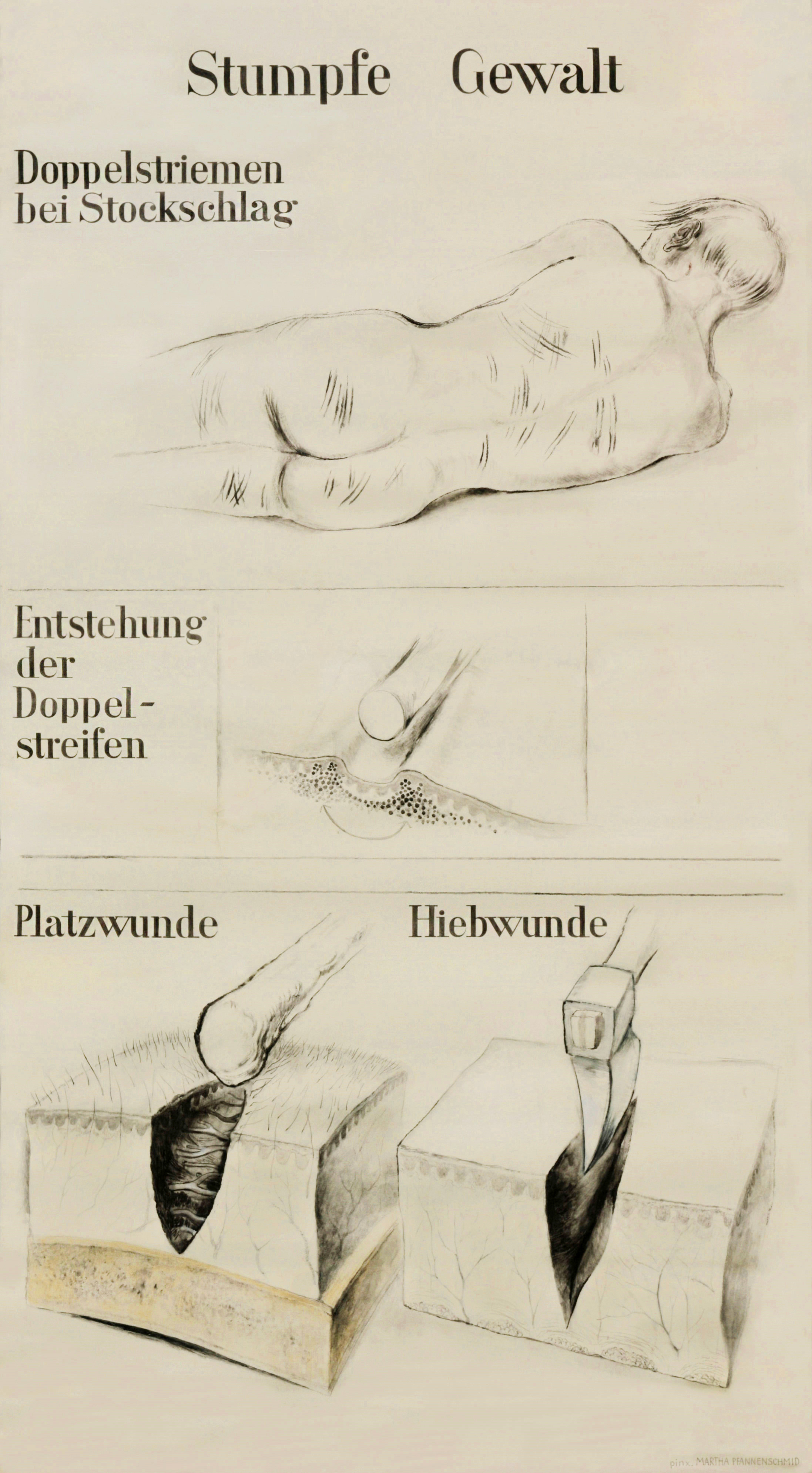 Martha Pfannenschmid, Lehrtafel © IRM Basel